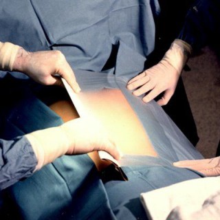Разрезаемые хирургические пленки 3М™ Steri Drape, 1051